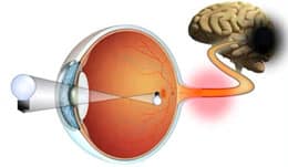 O que ocorre no glaucoma é uma destruição progressiva das fibras nervosas do nervo óptico que ficam no fundo do olho. Isso compromete a transmissão de imagem do olho para o cérebro. Na prática, a pessoa vai perdendo a visão.